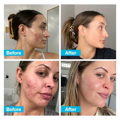 [First Order One-Time Bonus] FREE CLEARSKIN™